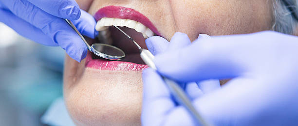 Best Teeth Whitening  in Hugo, OK